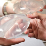 Breast Implants