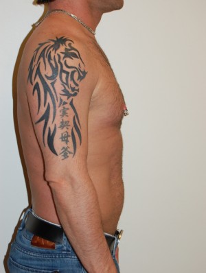 Male Pectoral Implants Case 4776 Before Photo Male Pectoral Implants