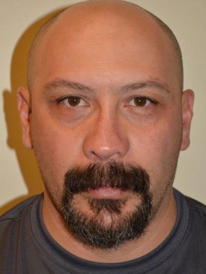 Nose Surgery Case 5524 After Photo Nose Surgery