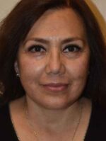 Facelift and Necklift