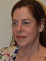Facelift and Necklift