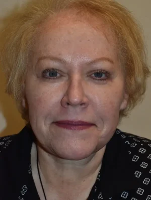 Facelift and Necklift