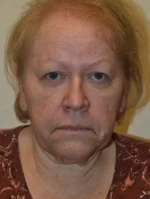 Facelift and Necklift