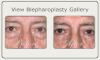 blepharoplasty thumb