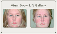 browlift thumb