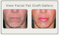 facial fat thumb